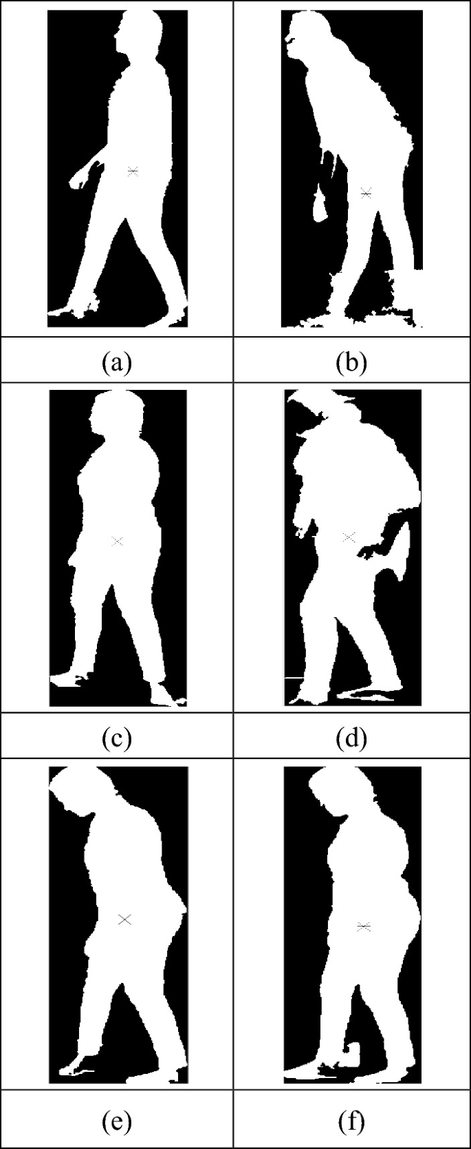How Gower's Sign Can Show Early Duchenne Muscular Dystrophy (DMD) | myMDteam, image size:685x1668