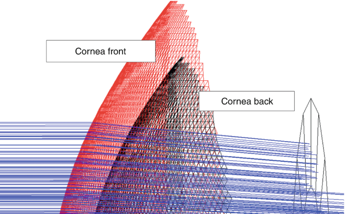 A graphical representation exhibits the structure of the cornea, with labeled sections including cornea front and cornea back, distinguished by lines and patterns.