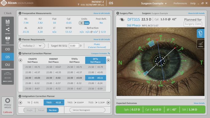 A screenshot of the Alcon vision planner. Left, it displays tabs and menus with preoperative measurements, planner requirements, and spherical and astigmatism correction planner. Right, it displays an image of an eye with overlaid graphics highlighting correction lines and astigmatism angles.