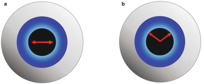 2 schematic representation of the frontal view of the eyeball. A, a double-headed arrow pointing left and right is in the inner circle. B, a V-shaped arrow is in the inner circle.