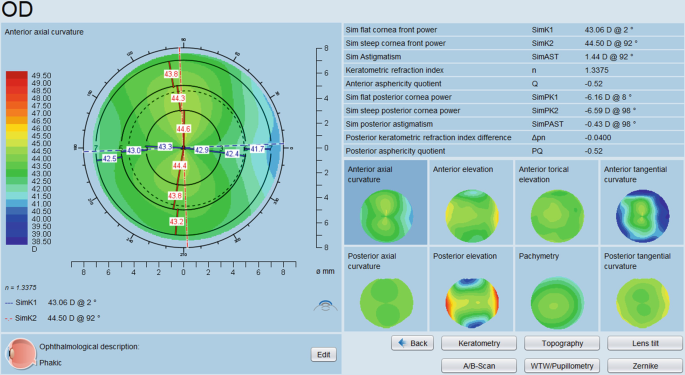 A screenshot titled O D. Left, a color-gradient circular plot represents the eye for anterior axial curvature. Right, a list of values for cornea measurements and 8 color-gradient plots for measurements of curvatures and elevations.