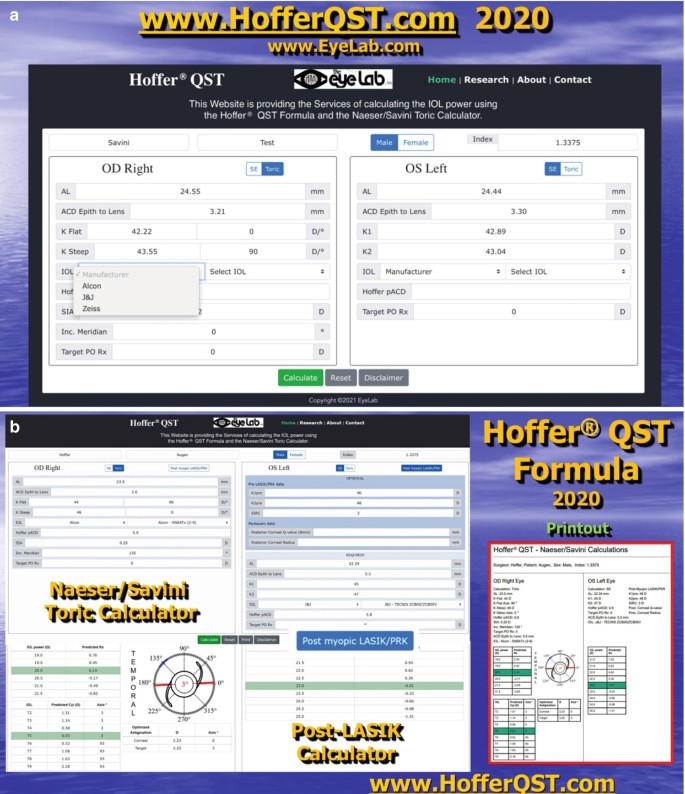 A screenshot of the Hoffer Q S T formula calculator 2020. It consists of fields for standard calculation of O D right and O S left, Nesser or Savini toric calculator, post L A S I K calculator, and the printout of results.
