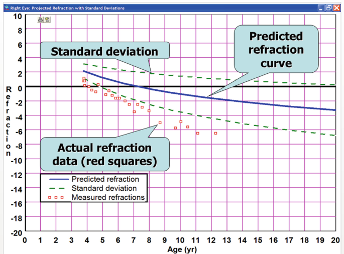 A graph from an application exhibits predicted refraction curve, standard deviation, and actual refraction data plotted against age in years for the right eye, with annotations for clarity.
