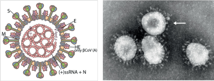 2 illustrations. A, depicts the structure of SARS CoV 2 with spike proteins, membrane proteins, and others. B, depicts an electron microscopy image of SARS-CoV with an arrow pointing at a single virion.