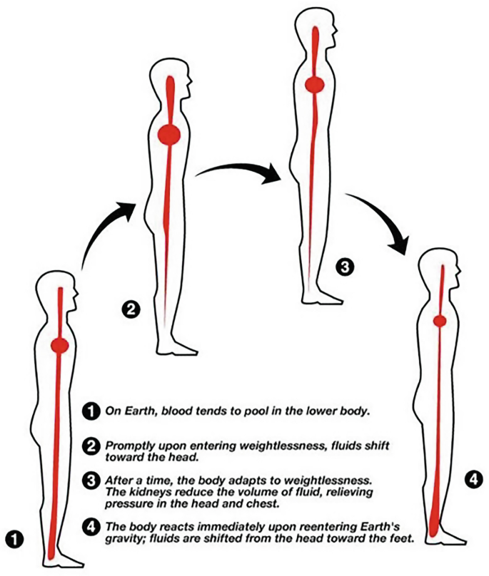 A schematic presents, 1, on Earth, blood tends to pool in the lower body, 2, entering weightlessness fluids shift toward the head, 3, after a time body adapts to weightlessness, the kidney reduces the volume, 4, reentering Earth, fluids are shifted from the head toward the feet.