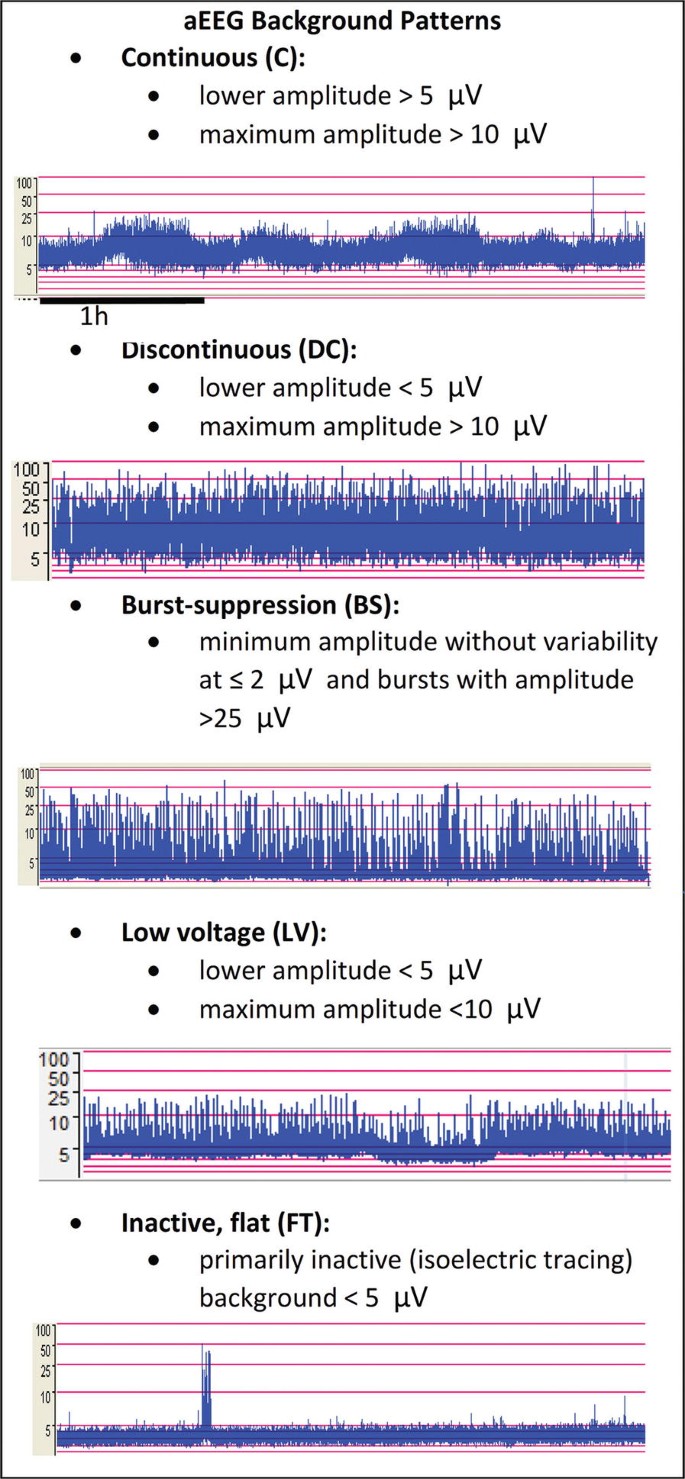 aEEG background patterns: continuous (C), discontinuous (DC), burst-suppression (BS), low voltage (LV), and inactive/flat (FT), with their amplitude criteria.