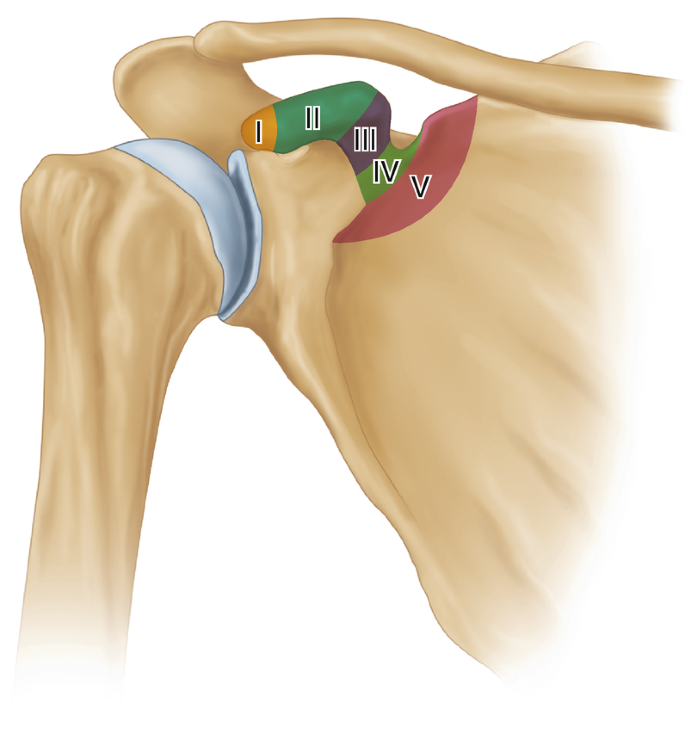 Classification Systems for Scapular Fractures: How Useful Are They ...