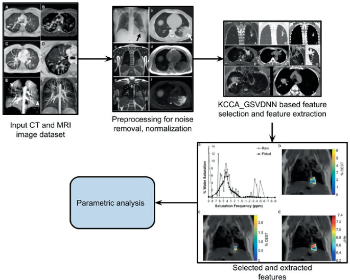 Ct And Mri Image Based Lung Cancer Feature Selection And Extraction 