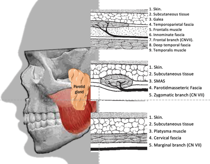 Fundamentals of Esthetic Facial Plastic Surgery SpringerLink