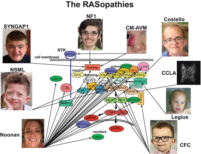 What Is a RASopathy? | SpringerLink