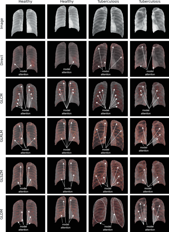 SRFAMap: A Method for Mapping Integrated Gradients of a CNN Trained ...