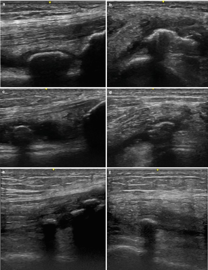 Ultrasonography of the Knee | SpringerLink