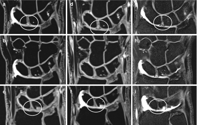 Nine scans display the contrast used in the M R A stayed within the intended area and did not spill into the M C joint.