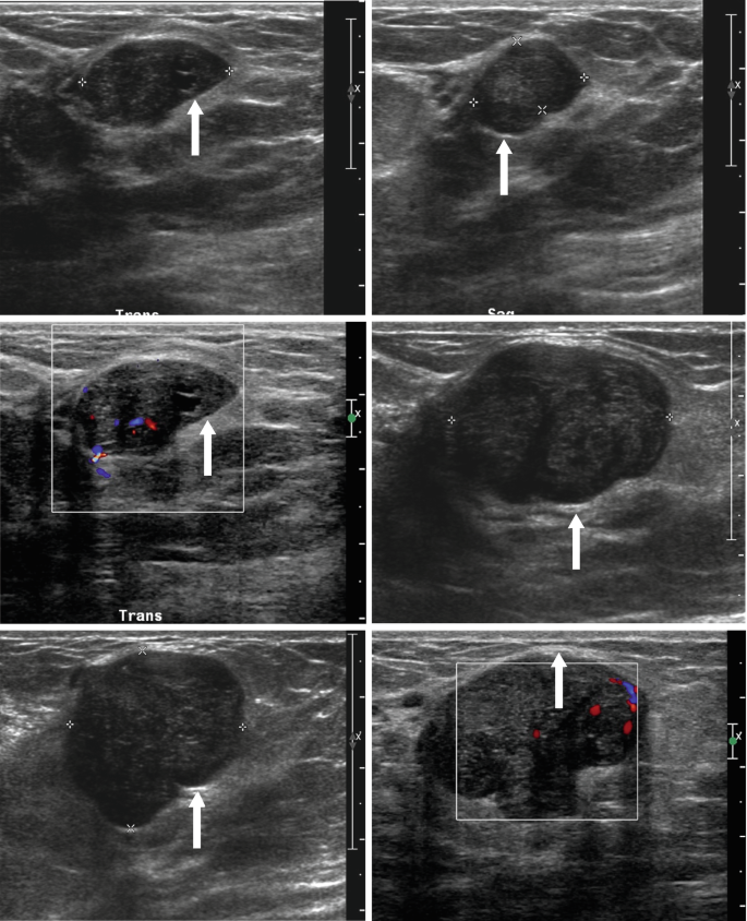 Patterns on Ultrasound | Springer Nature Link (formerly SpringerLink)