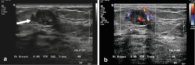 Patterns on Ultrasound | Springer Nature Link (formerly SpringerLink)