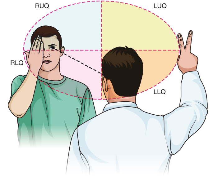 Visual Quadrant Testing The Neuro Exam | SpringerLink