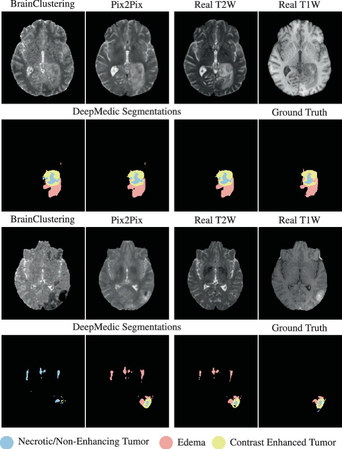 MRI Scan Synthesis Methods Based on Clustering and Pix2Pix | Springer ...
