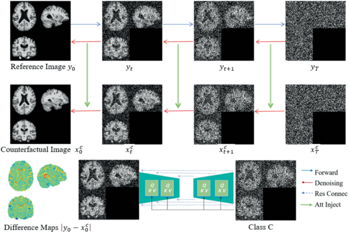 Controllable Counterfactual Generation for Interpretable Medical Image ...