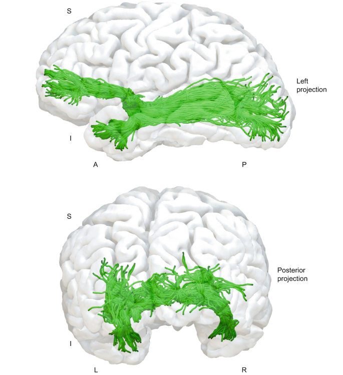 Anterior Commissure | Springer Nature Link (formerly SpringerLink)