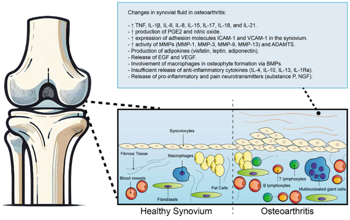 Multi-Omic Approaches for the Evaluation of the Synovial Joint Fluid ...