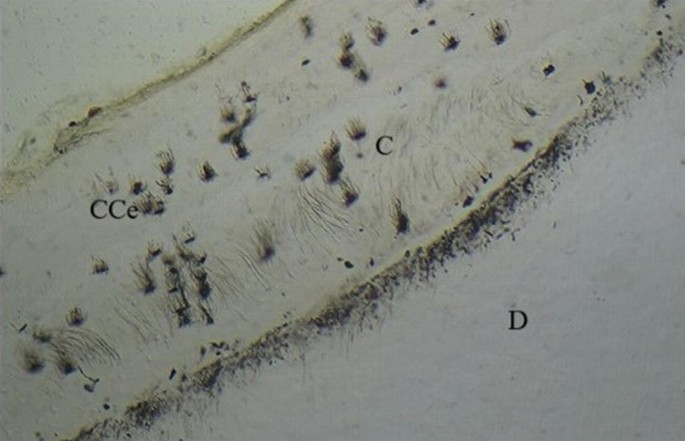 Histology of Cementum and Cementogenesis | SpringerLink
