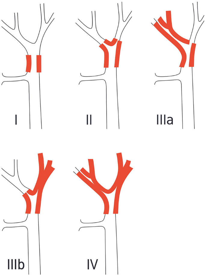 Biliary Tract Tumors | Springer Nature Link