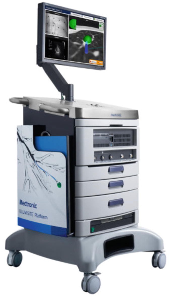 Digital Tomosynthesis in Interventional Pulmonary Medicine: Principles ...