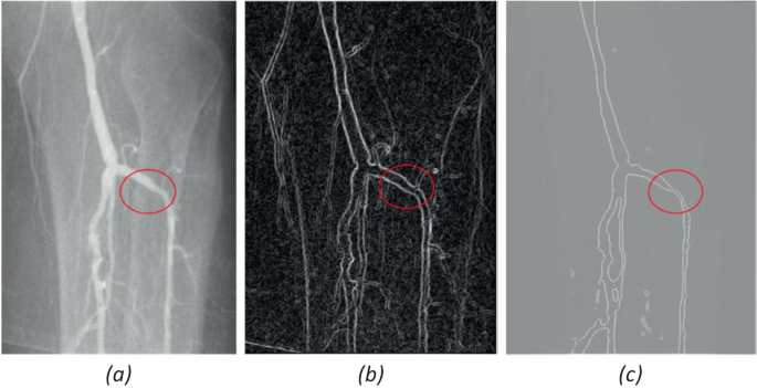 Angiogram Display The Myth of Big Data | SpringerLink
