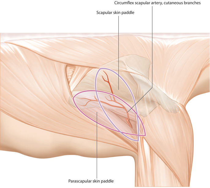 Scapular Flap | Springer Nature Link