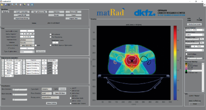 Matrad Radiotherapy Treatment Planning: An Integrated Optimization and ...