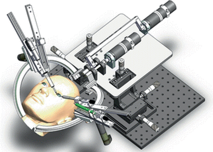 Robotic Eye Surgery | Springer Nature Link