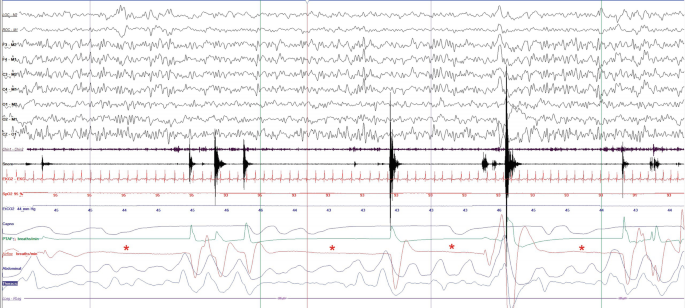 Bianchi Cielo 2009改 18" Tiagra10s 50-34T 12-32 メカ一部105・SLX他 サイコン・鍵・輪行袋付 メカの半分はほぼ新品 タイヤほｈぼ新 Development of an Acrylate Derivative Targeting the NLRP3