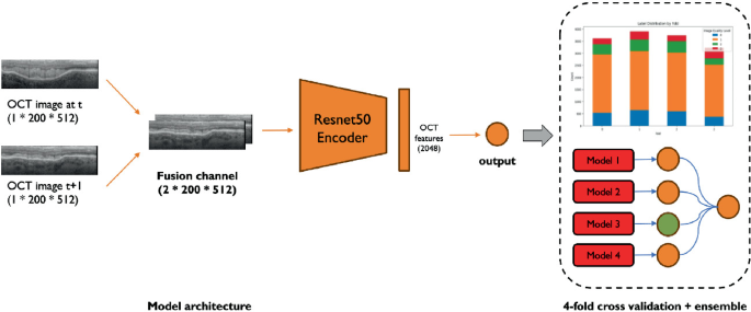 Oct Fusion Patch Progression Masked Autoencoder with Fusion CNN Network for ...