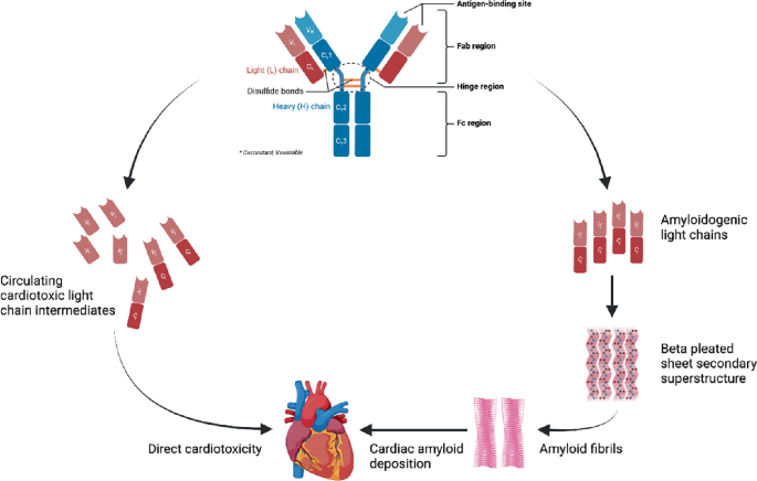 Cardiac Amyloidosis—History, Pathophysiology and Epidemiology ...