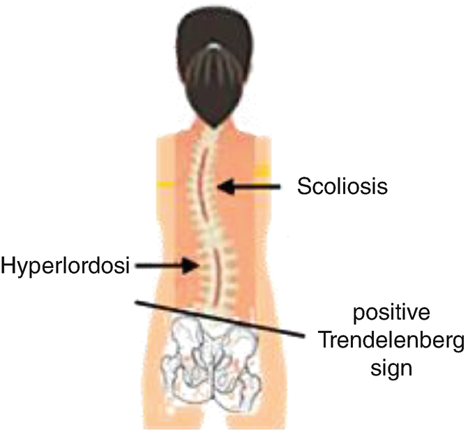 bpc 157 ehlers danlos Top Rated Ehlers-Danlos Syndrome Treatment Center in the USA