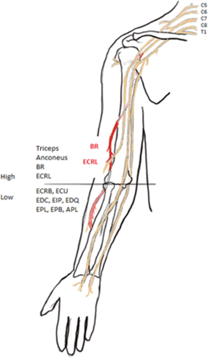 Upper Extremity Tendon Transfers | Springer Nature Link