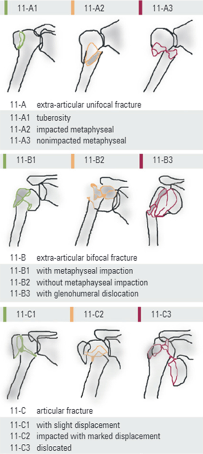 Approach to Shoulder Injuries | Springer Nature Link (formerly SpringerLink)