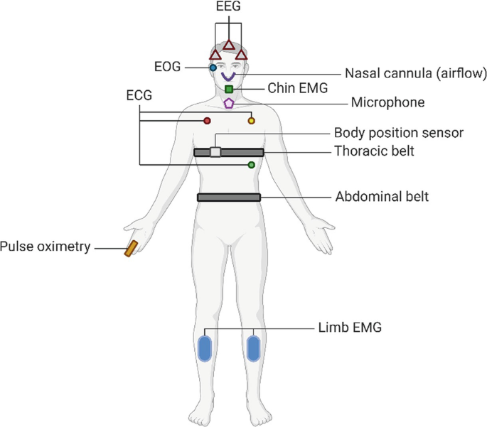 Sleep Labs: How We Study Sleep | SpringerLink