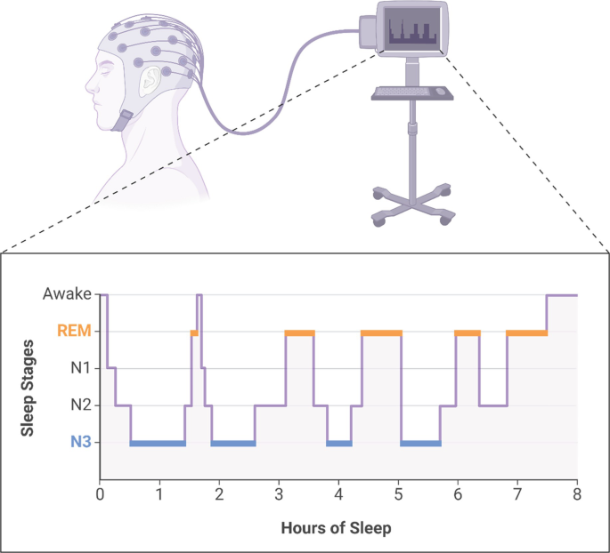 Sleep Labs: How We Study Sleep | SpringerLink