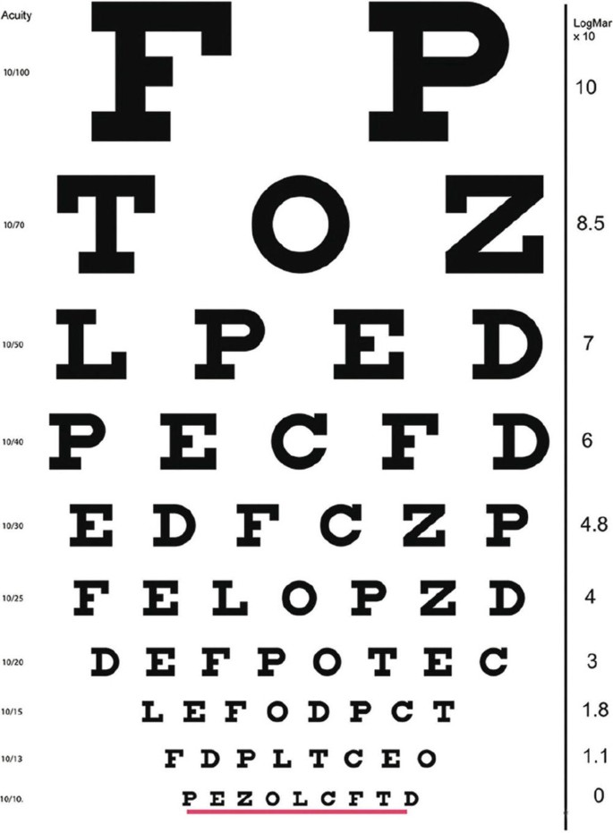 Dynamic Visual Acuity Testing of the Rotational Vestibulo-Ocular Reflex ...