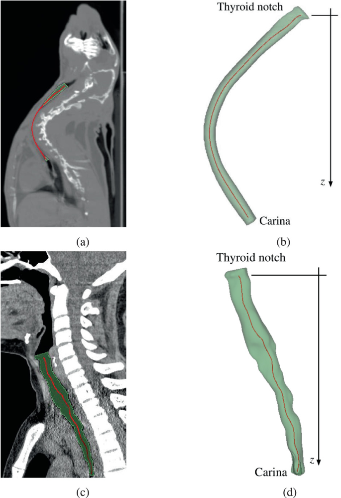 Trachea Radiology Detailing a Methodology for Obtaining the Trachea’s Cross-Sectional ...