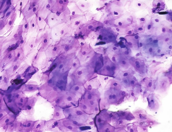 The Cyto-architectures (Arrangements) in Skin Cytology | Springer ...