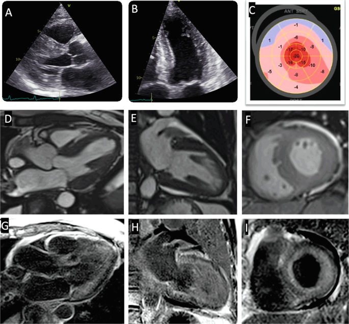 Role of Cardiovascular Magnetic Resonance Imaging in Heart Failure ...