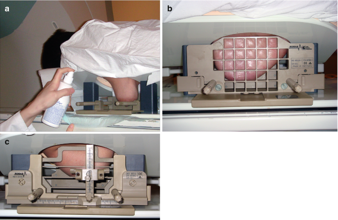 MR-Guided Breast Intervention | Springer Nature Link