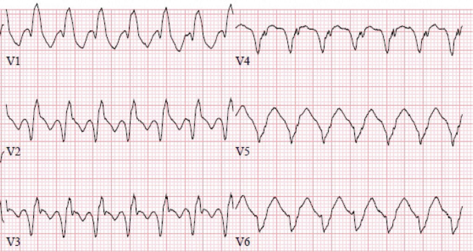 ECG 19 | Springer Nature Link