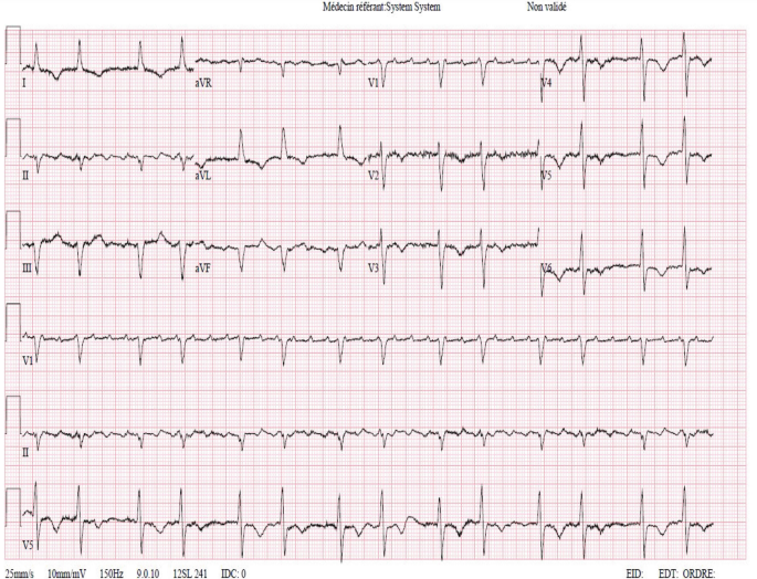 ECG 22 | SpringerLink