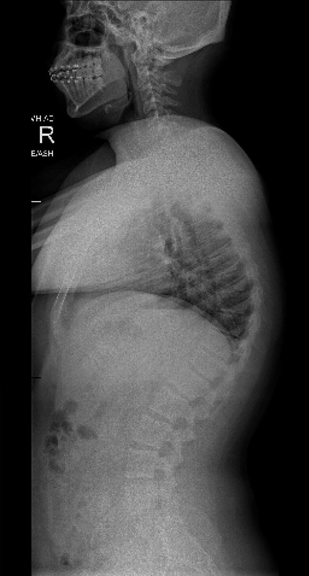 Other Spine Conditions MCQs | Springer Nature Link