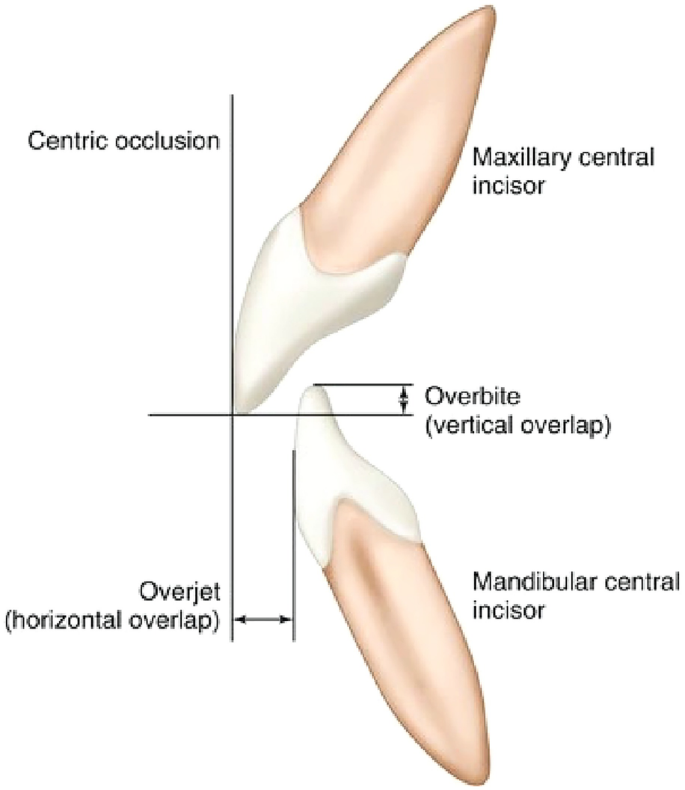 Orthognathic Surgery | Springer Nature Link