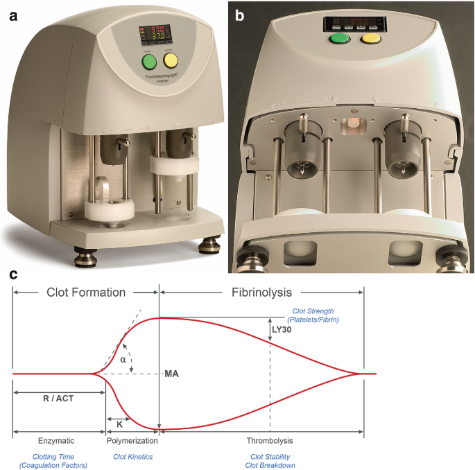 Postoperative Coagulation and Bleeding: Monitoring and Hematologic ...
