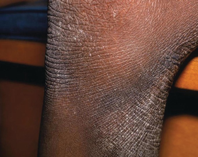 Brazen Skin Example The Skin | Springer Nature Link
